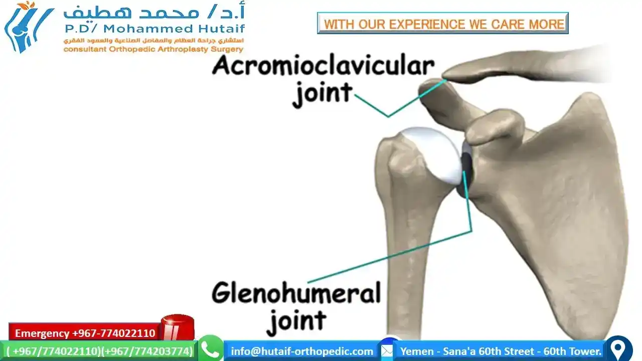  Osteoarthritis is the most common form of arthritis, affecting millions of people worldwide. It occurs when the protective cartilage that cushions the ends of the bones wears down over time.. There are two joints in the shoulder, and both may be affected by Osteoarthritis . One joint is located where the clavicle meets the tip of the shoulder blade (acromion). This is called the acromioclavicular (AC) joint. The second is where the head of the humerus fits into the scapula and is called the glenohumeral joint, however Shoulder osteoarthritis is a common name for glenohumeral osteoarthritis, a condition that involves degenerative changes to the cartilage and other structures in the glenohumeral joint. Shoulder osteoarthritis causes pain and stiffness that can make it difficult to lift your arm, brush your hair or reach up to a high shelf. Osteoarthritis symptoms can usually be managed, although the damage to joints can't be reversed