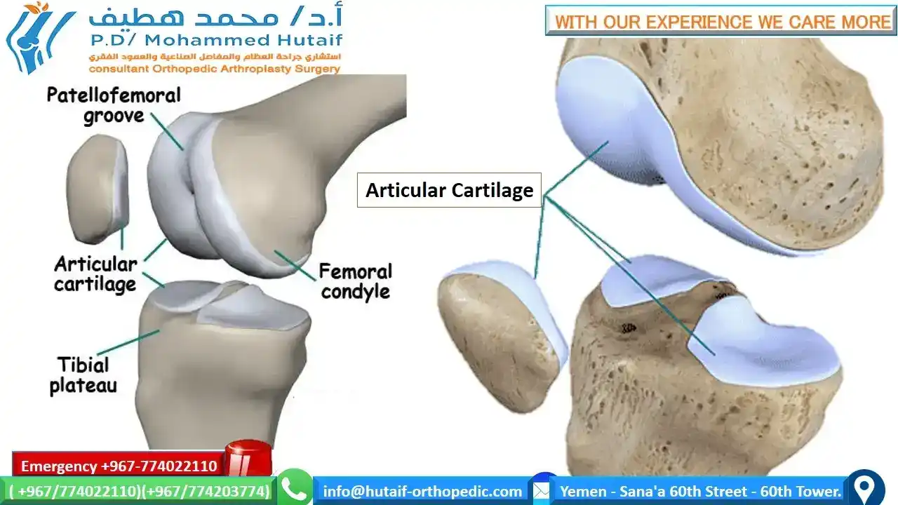 EXCELLENT ORTHOPEDIC DOCTOR YEMEN