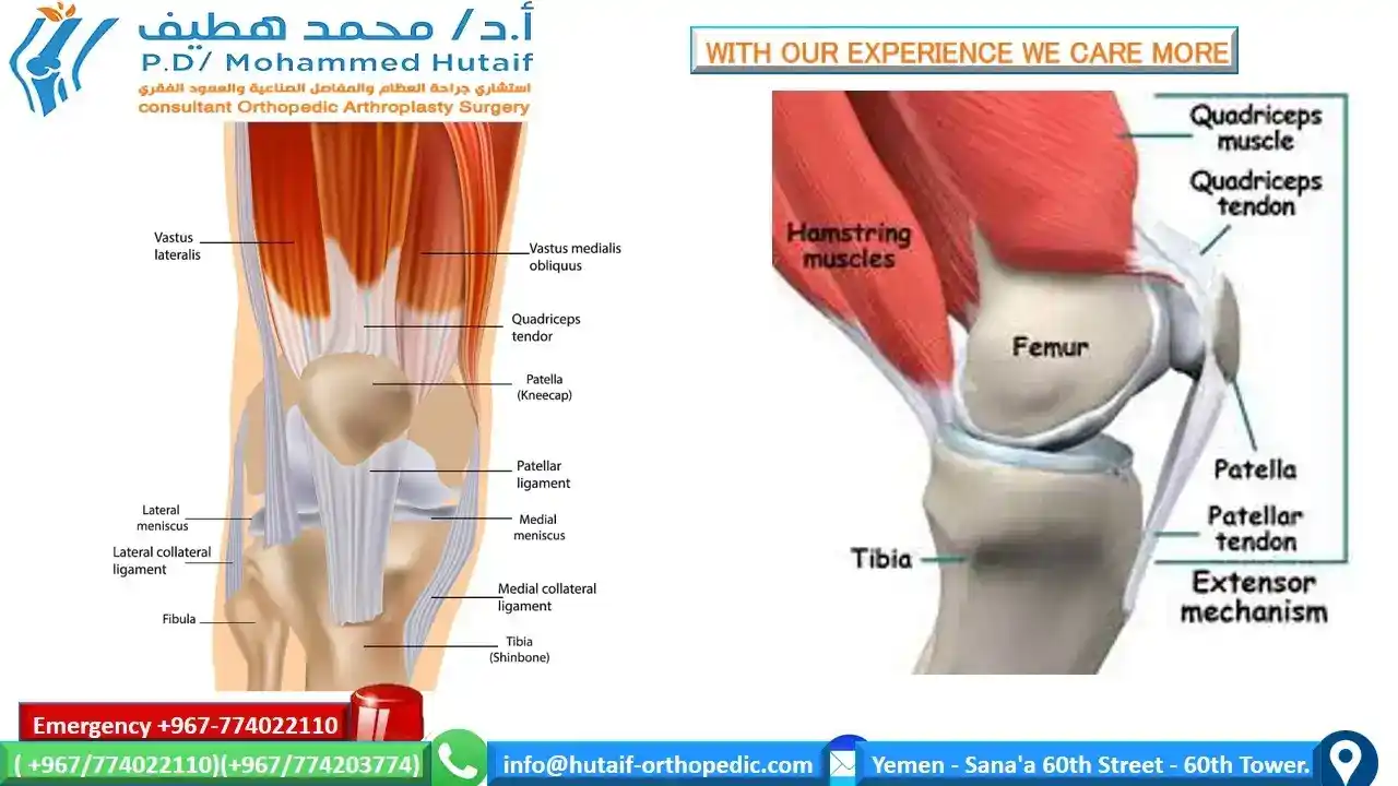 EXCELLENT ORTHOPEDIC DOCTOR YEMEN