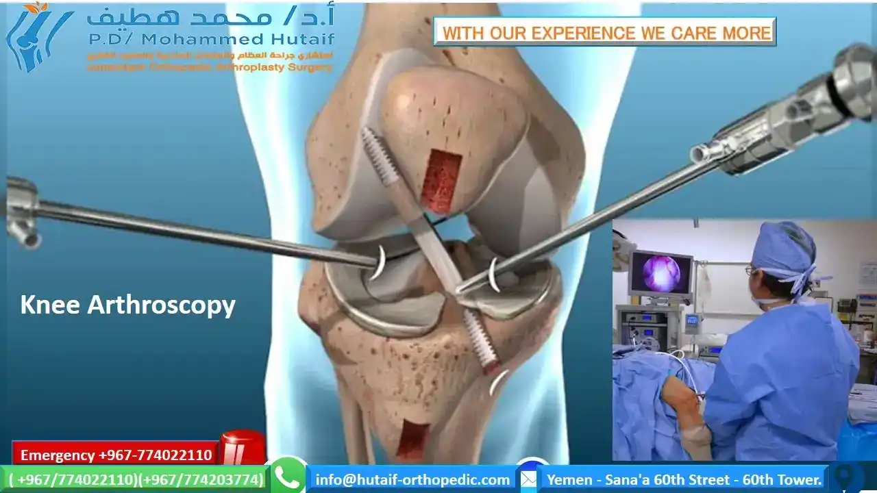 The best excellent orthopedic doctor The best excellent Arthroplasty doctor The best excellent spine doctor