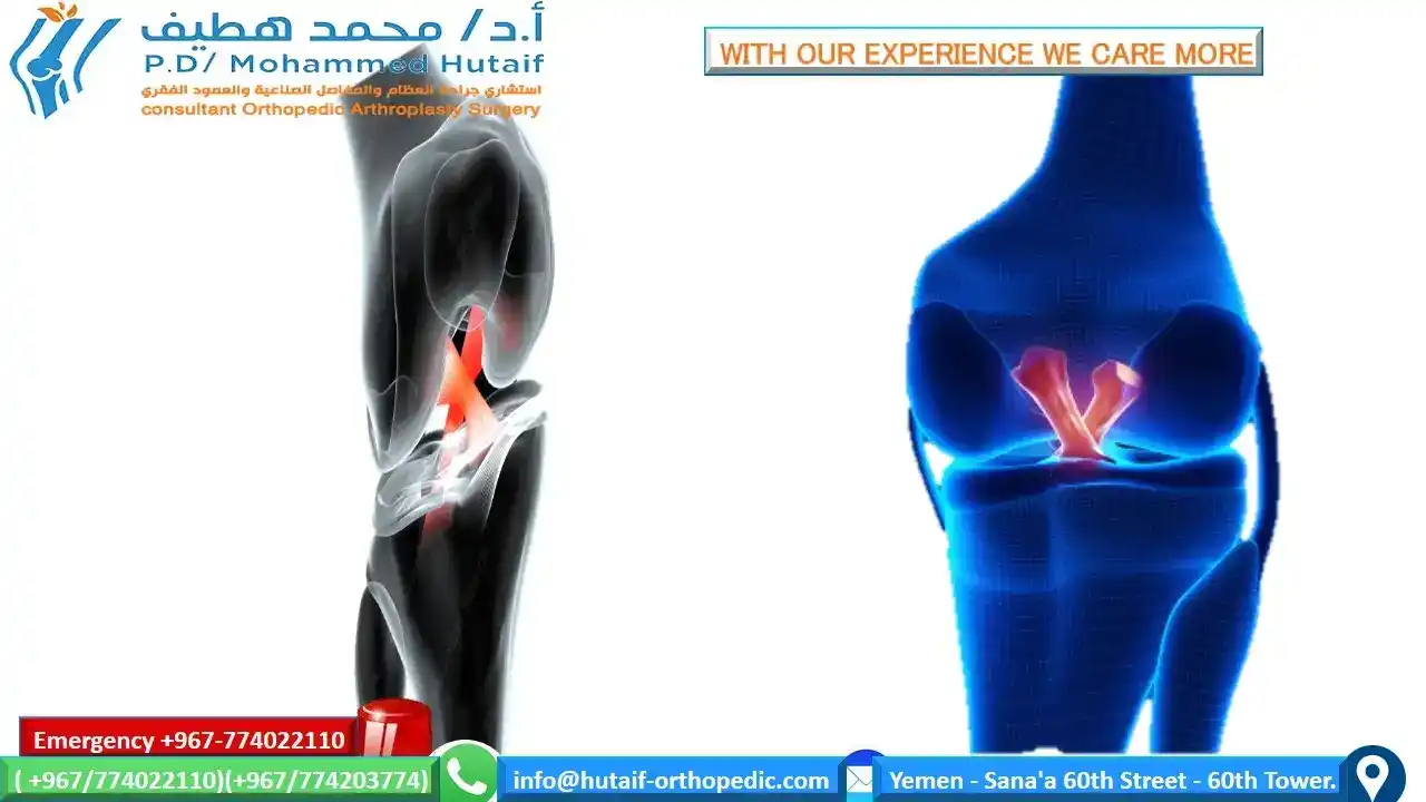 The best excellent orthopedic doctor The best excellent arthroplasty doctor