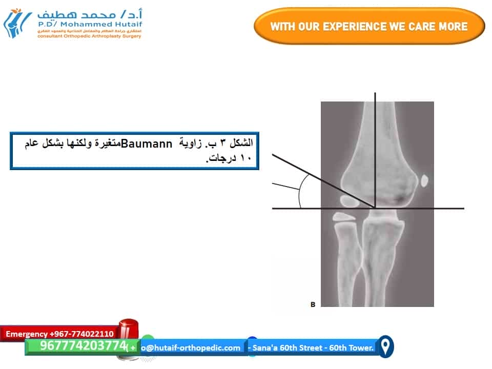 افضل دكتور عظام