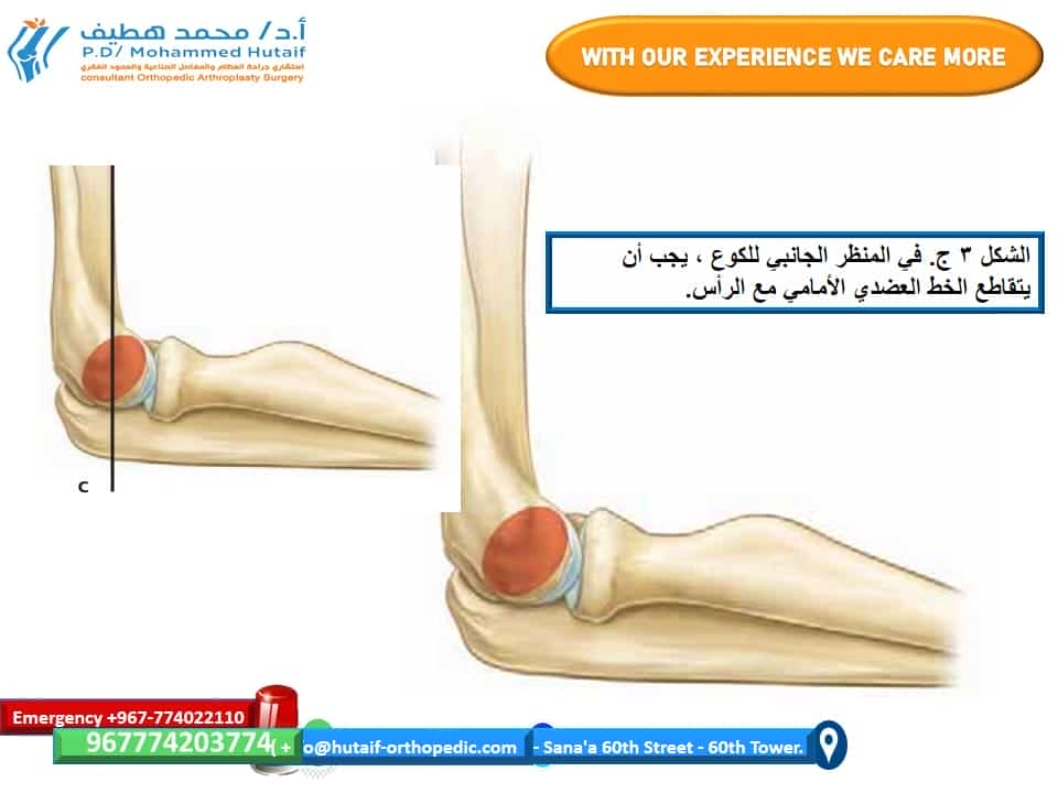 افضل دكتور عظام