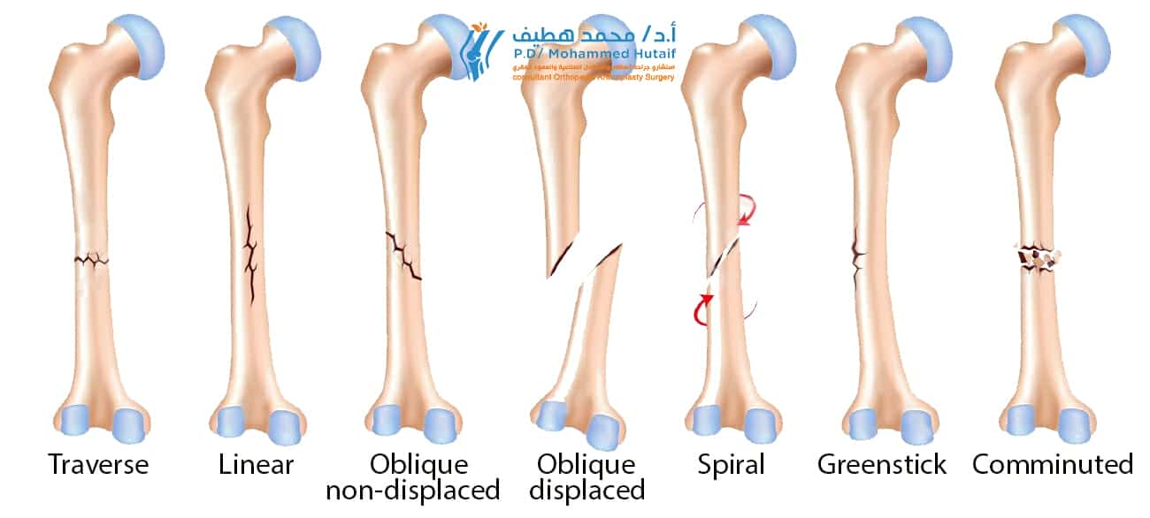 Best orthopedic surgeon Yemen 