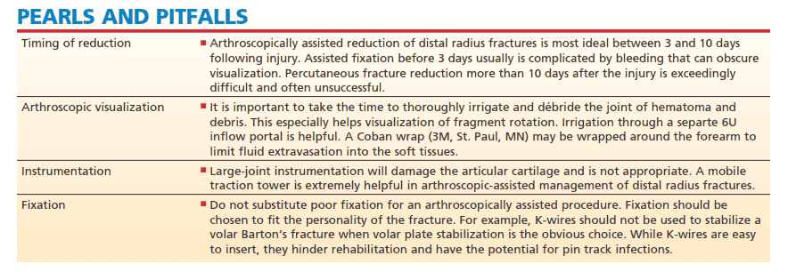 Best Timing for Reduction, Arthroscopic Visualization, Instrumentation, Fixation, and Observation