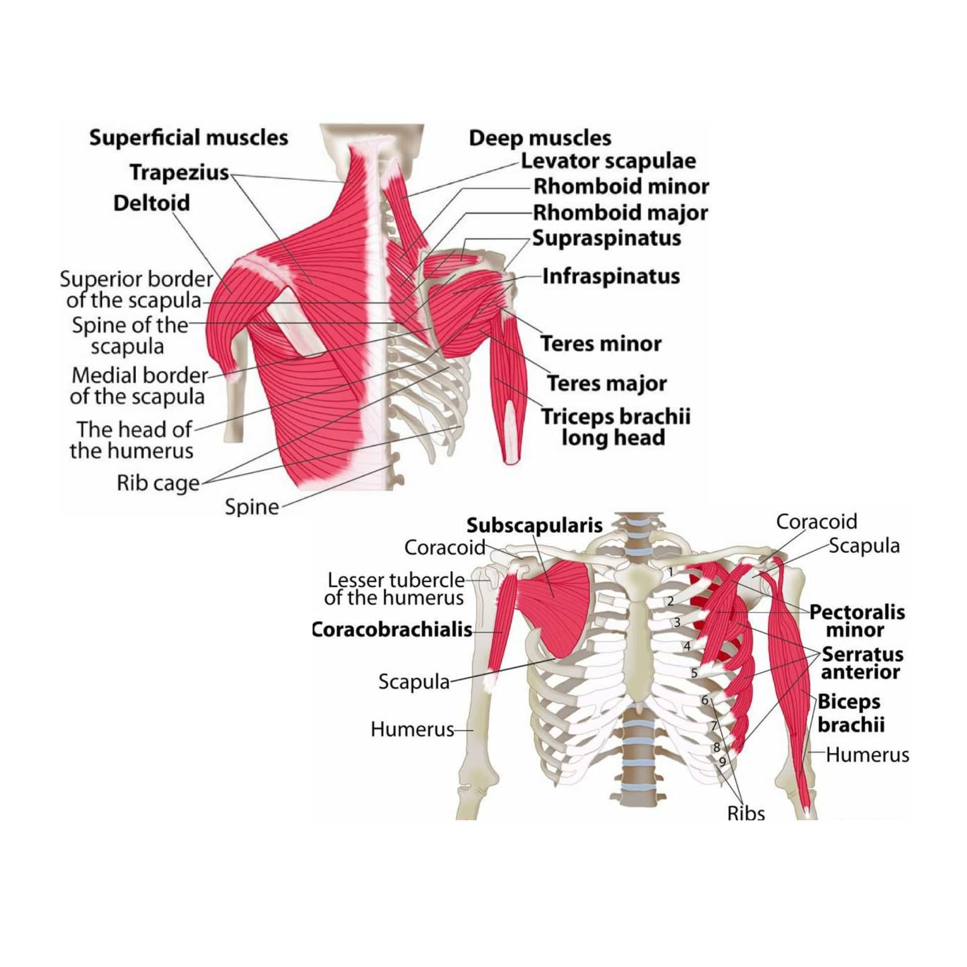 Scapula fracture 