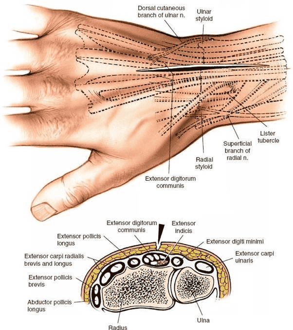 Figure 5-2 Skin incision for the dorsal approach to the wrist joint. A cross section at the distal portion of the radius is seen.