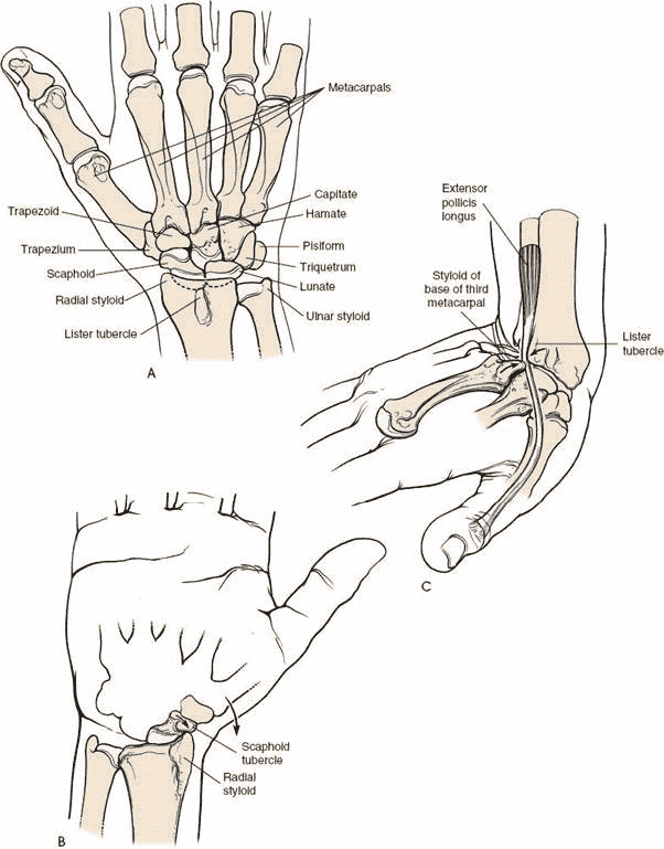 Figure 5-14  A:  Dorsal  aspect  of  the  bones  of  the  distal  forearm,  wrist,  and proximal hand. B: A strong and sudden radial deviation of the wrist may cause the radial styloid process to impinge on the scaphoid tubercle and fracture it. C: With sudden extreme dorsiflexion of the wrist, as when one falls on an outstretched hand, the extensor pollicis longus tendon may be trapped or crushed between the dorsal radial tubercle (Lister tubercle) and the base of the third metacarpal.