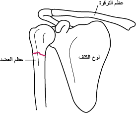 كسر الكتف