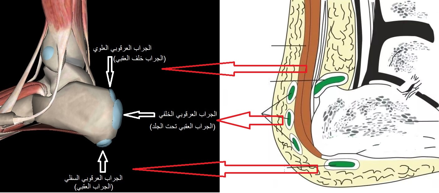 الجراب العرقوبي الخلفي