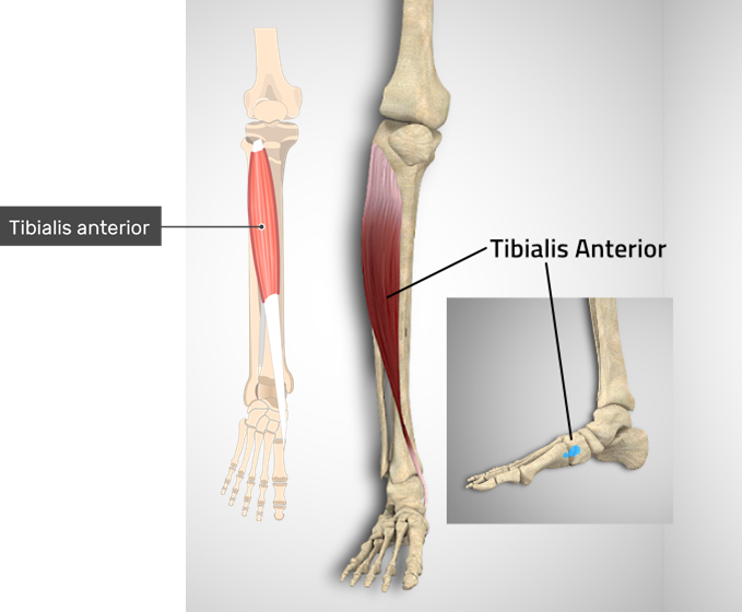 Understanding the Muscles of the Anterior and Lateral Compartments of ...