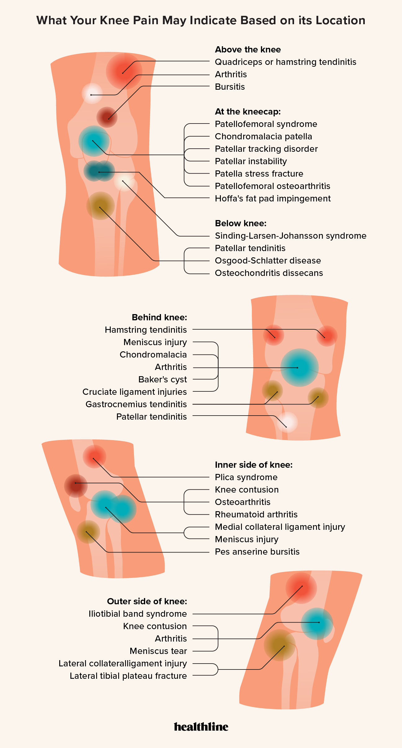 Knee Pain Charts