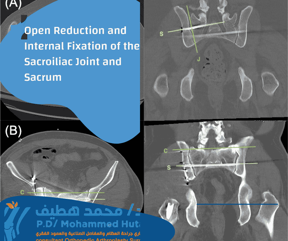 Healthy Street - WHAT'S UNDER THE SACRUM? The sacrum is a large